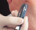 תמונה של בנאדם Dopplex Diabetic Foot Assessment Kit